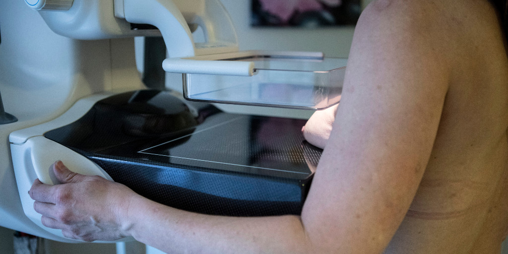 En kvinna genomgår mammografi, en undersökning som brukar utföras vartannat år.