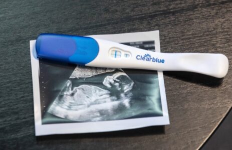 Graviditetstest på en ultraljudsbild på ett foster.